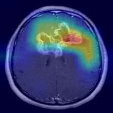 Sample Grad-CAM heatmap