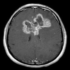 Sample MRI input